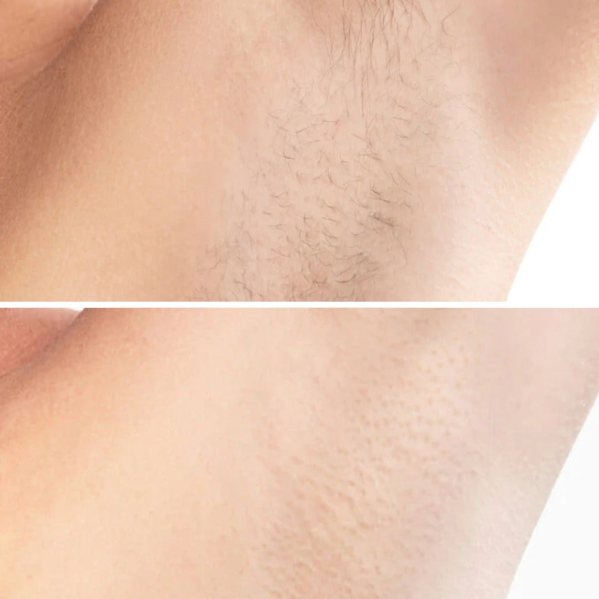 LUXE Silk Pro IPL Hair Removal Device